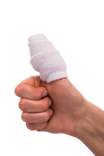 Utvalet foreslår at kravet til medisinsk invaliditet som utløyser erstatning...