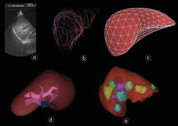 Clinical use of 3D-ultrasound