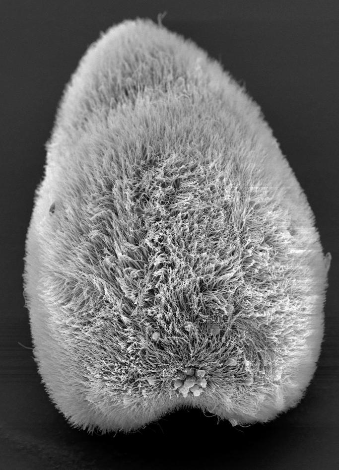 Acoel Juvenile, microscope