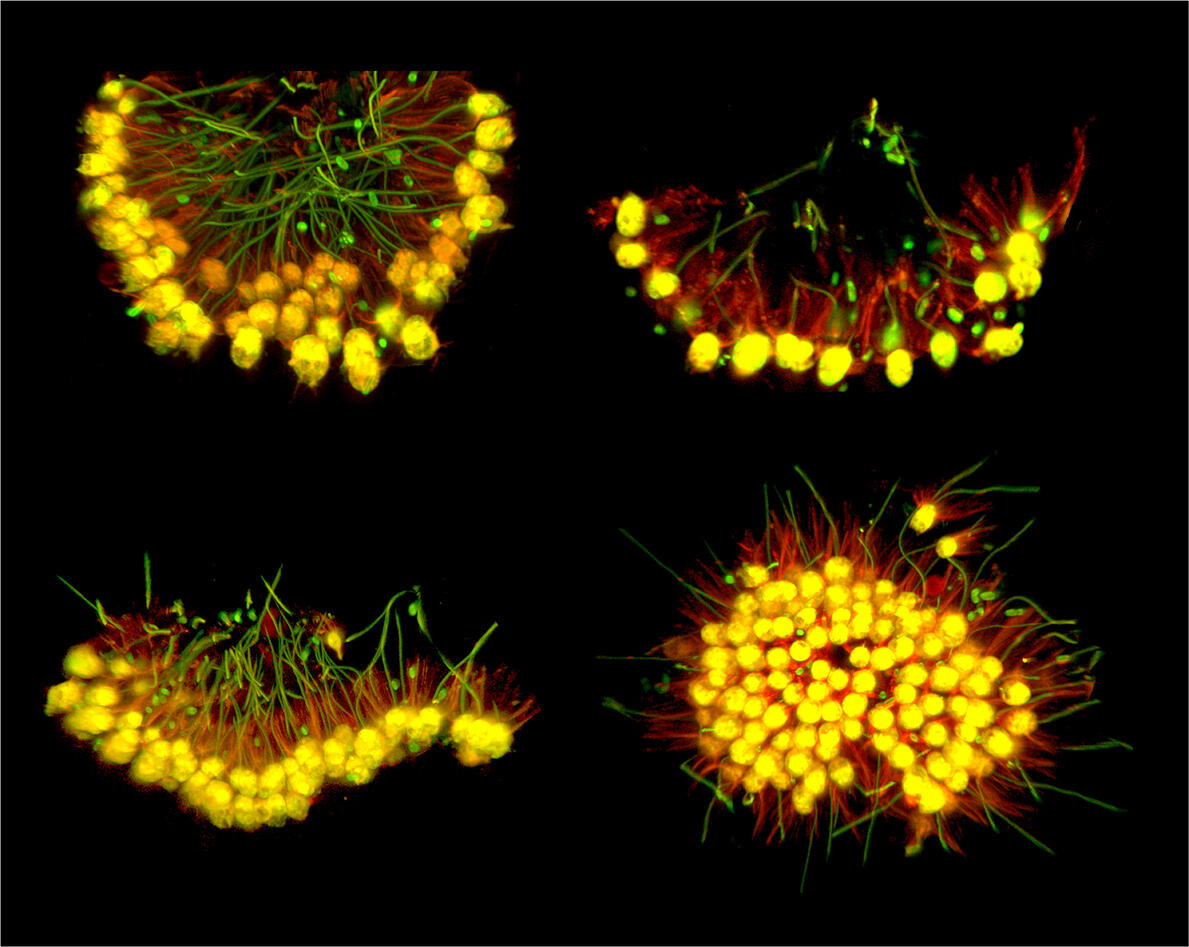 Stages in the inversion behavior of C. flexa illustrated in distinct fixed samples (green = cytoplasm, red = F-actin).