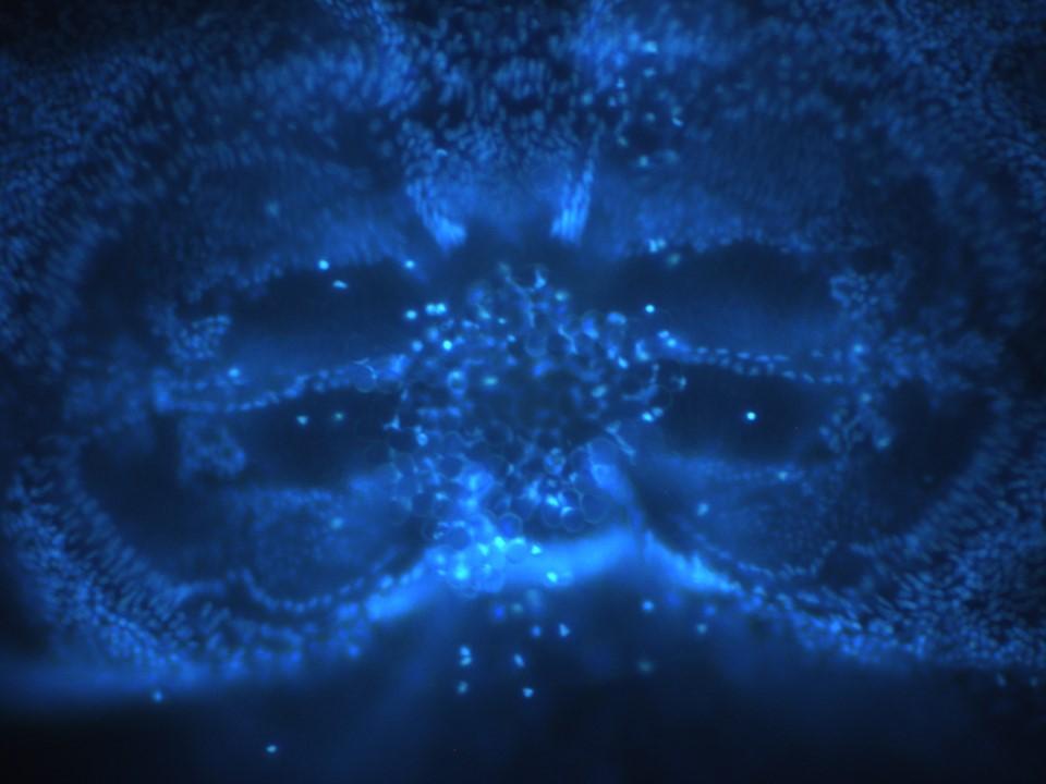 Ctenophore statocyst