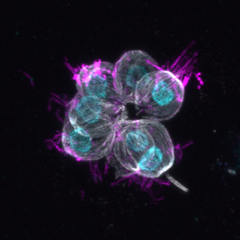 choanoflagellates
