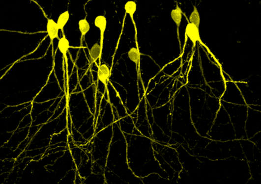 Image of nerve cells