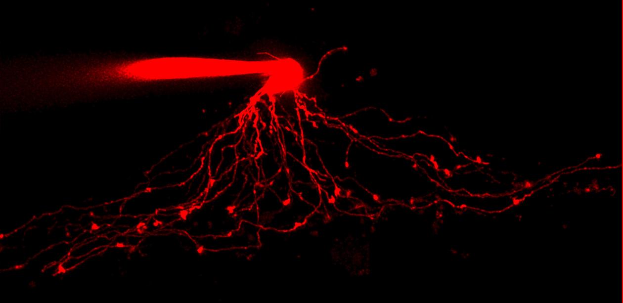 A17 amacrine cell filled with Alexa Fluor 594 via patch pipette. Maximum intensity projection (along z-axis) generated from two-photon fluorescence image stack after deconvolution (J Neurosci 2015; 35: 5422-5433)
