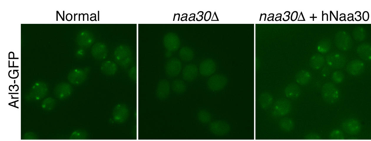 The image shows a panel of three fluorescence microscopy images of the acetylation of Arl3-GFP in yeast.