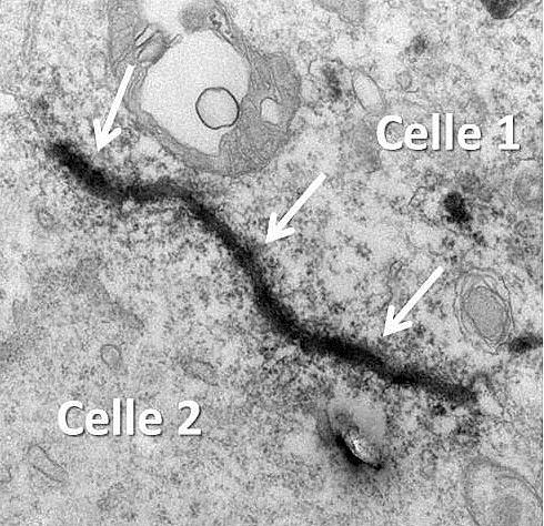 Bilete 1: Det øydelagde CEL-proteinet har klumpa seg saman og pilane syner kor det har lagt seg som ei hinne mellom to celler.