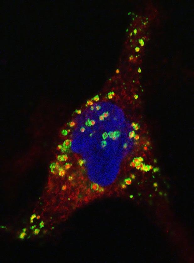 Bilete 2: Celle som har tatt opp i seg øydelagt CEL-protein. De raude prikkane er proteinet som er omgitt av ein grønfarga membran.