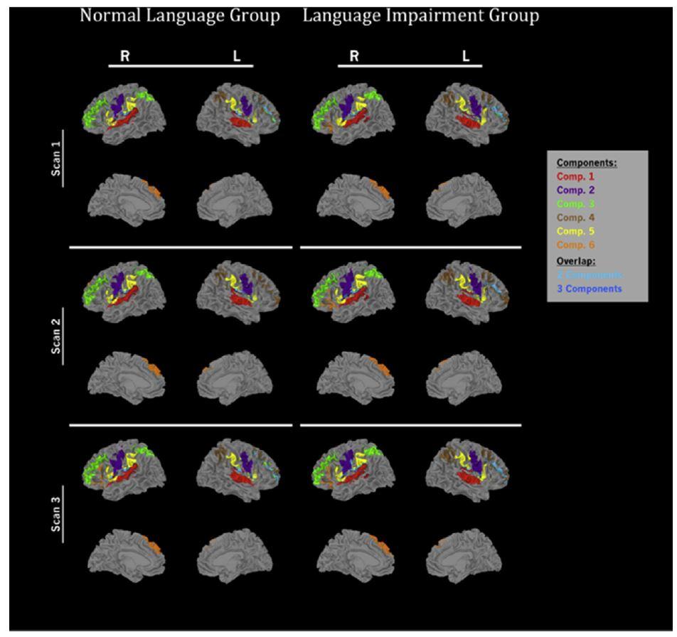 Aktivering av hjernen under statistisk språklæring (http://dx.doi.org/10.1016/j.nicl.2017.01.027)