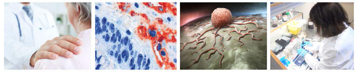 Collage of 4 photos from CCBIO labs, and cancer cells