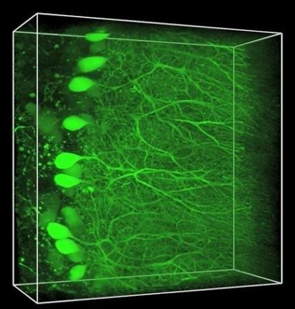 Green fluorescent Purkinje cells in a cerebellar section
