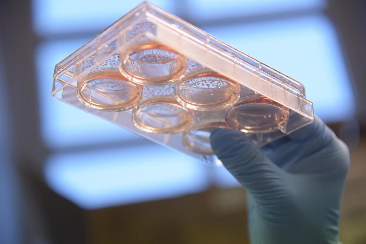 Kristina Xiao Liang er gruppeleder for Mitokondriell stamcelleforskningsgruppe ved Universitetet i Bergen