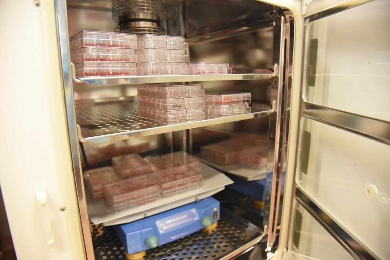 Kristina Xiao Liang på lab'en, dyrker frem mini-hjerner