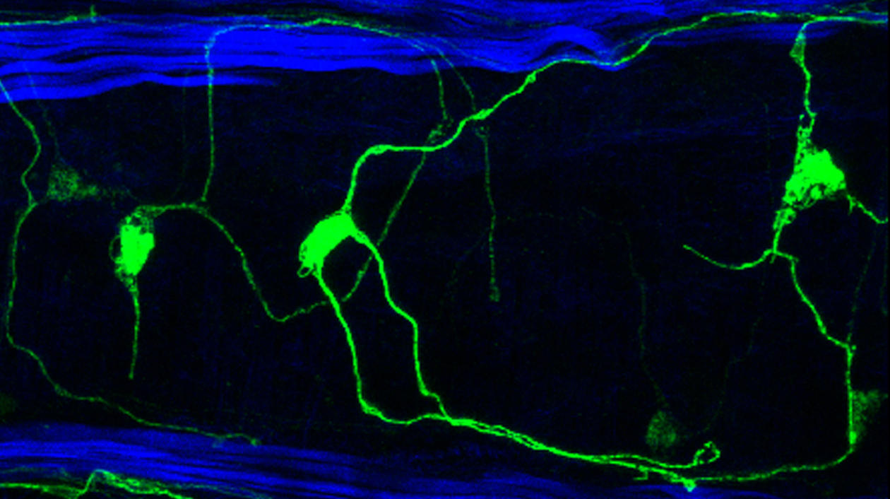 transient_elav1_labeling