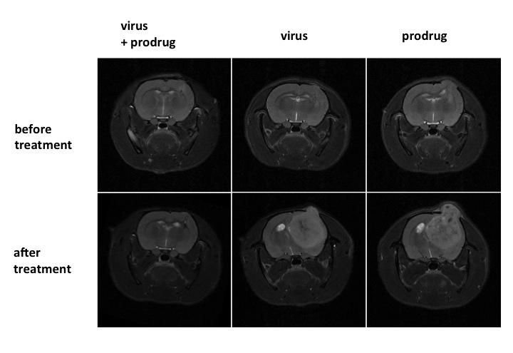 Suicide gene therapy with lentiviral vectors and a prodrug in a clinically relevant animal model for human glioblastoma. The therapeutic group (virus + prodrug) shows dramatic reduction in tumour size on MRI compared to control groups. Modified from Huszt