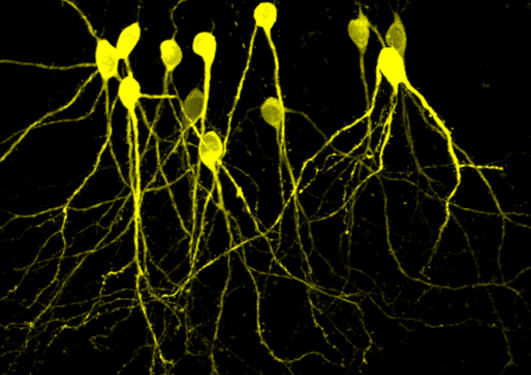 Live two-photon excitation imaging of dentate granule cells transduced with fluorescent protein (YPet2) by single-cell electroporation in organotypic rat hippocampal slice-cultures. Foto/ill.: Sergei Baryshnikov