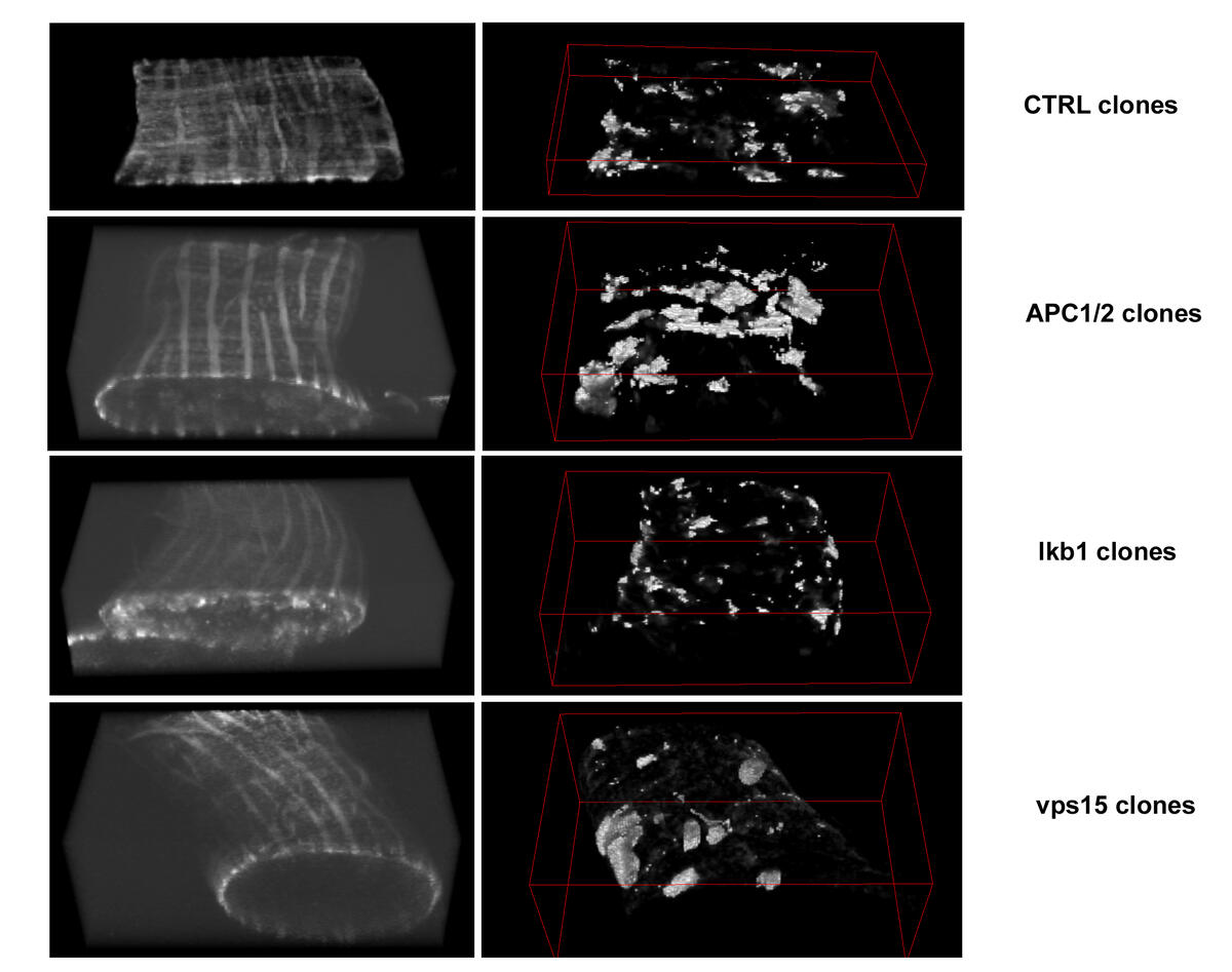 Gen ble testet for tendens til å danne svulster når de ble mutert inn i kloner merket med GFP (hvite, høyre paneler) i Drosophila-tarmen (3D venstre panel). Bildet viser panel med sammenligning av villtype mot muterte varianter.