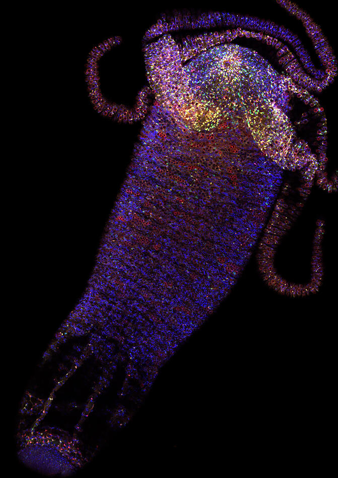 Hydra nervous system