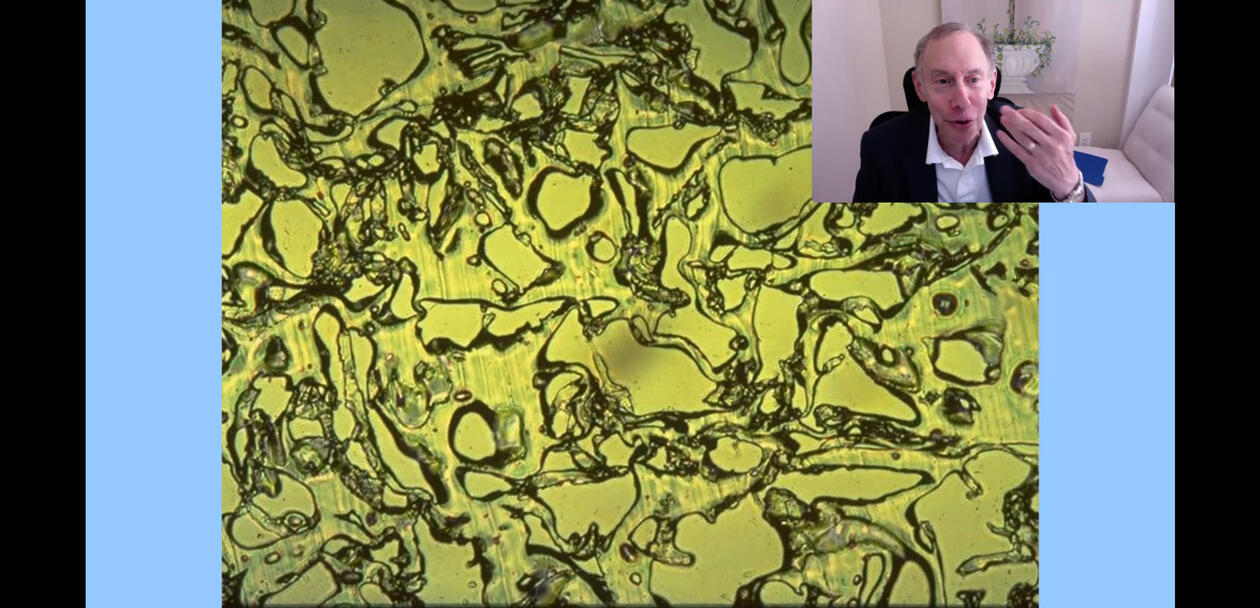 Screenshot from Zoom, with the speaker and a slide from the talk, showing microscopy imaging..