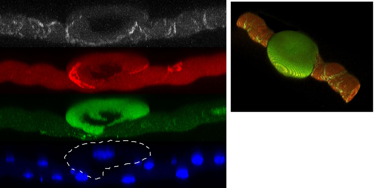 Bilde som viser enkeltcellekloner (i grønt) som overuttrykker Drosophila Ret-proto-onkogenet Stit, generert i malfigian tubuli til en Drosophila-larver (kjerner markert med blått). Celler ble farget med anti-armadillo (rød) for å markere cellegrenser.