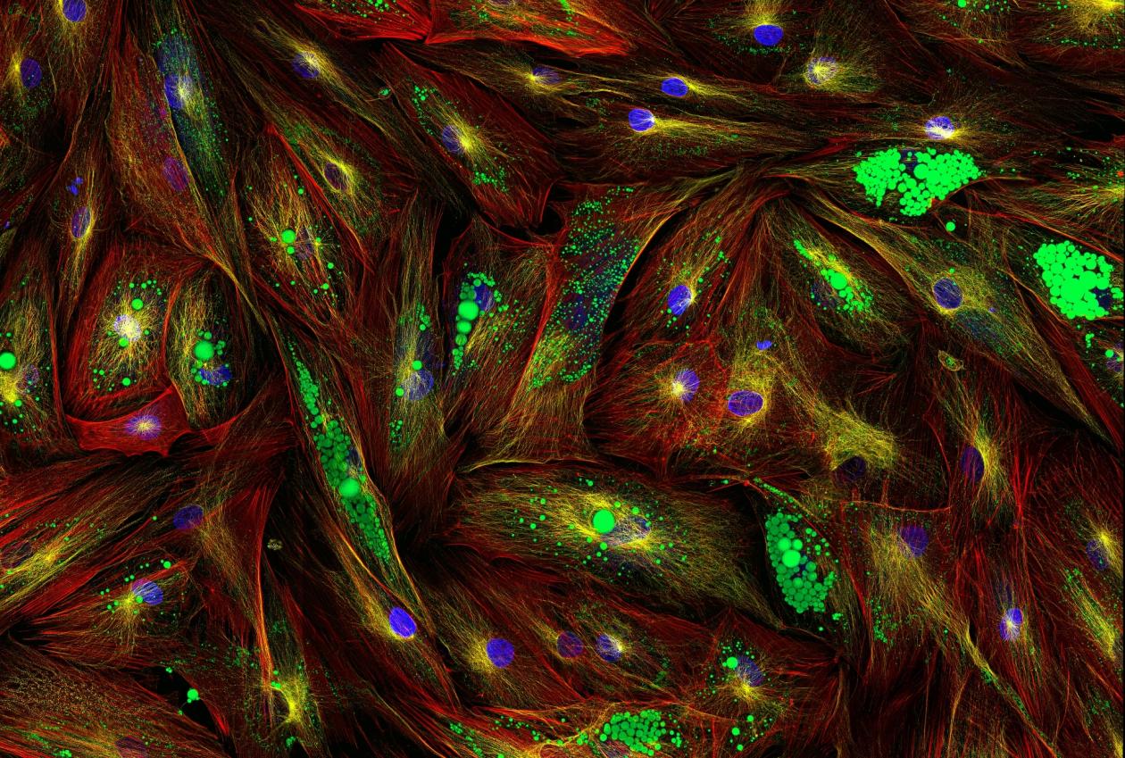 Ultrahøyoppløselig bilde av stamceller tatt gjennom mikroskop, opplyst med fluorescerende proteiner som gjør at enkelte molekyler "skinner" med grønn farge 