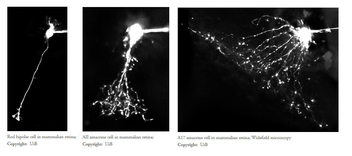 A17 amacrine cell in mammalian retina; Widefield microscopy