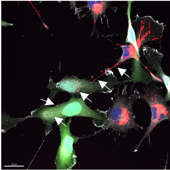 mitochondria_transfer