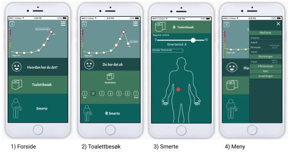 App som skal støtte personer med inammatorisk tarmsykdom