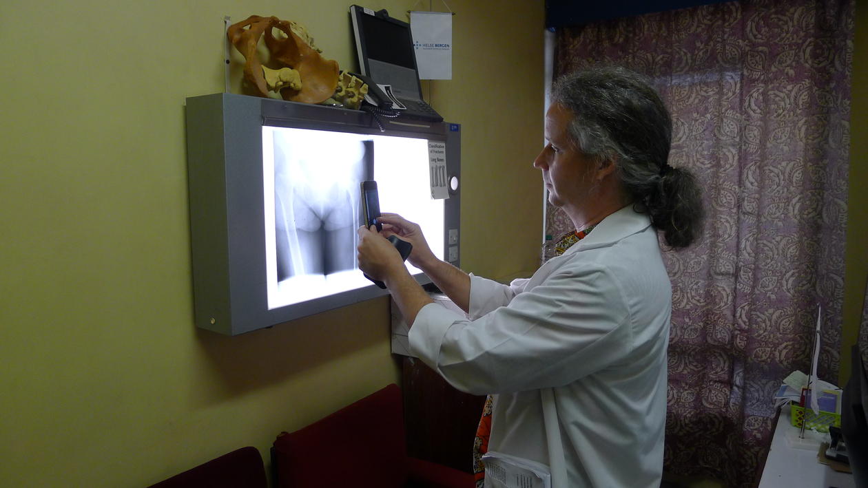 Spesiallege Sven Young tar et foto av et røntgenbilde med smarttelefonen sin på Kamuzu Central Hospital i Malawi, desember 2013.