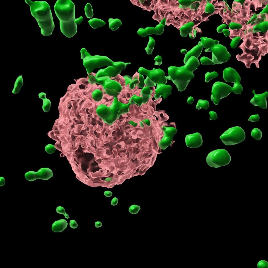 Bilde av en rose cellekjerne omringet av grønne store aggregater 
