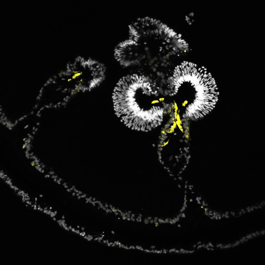 Cells seen under a confocal microscope