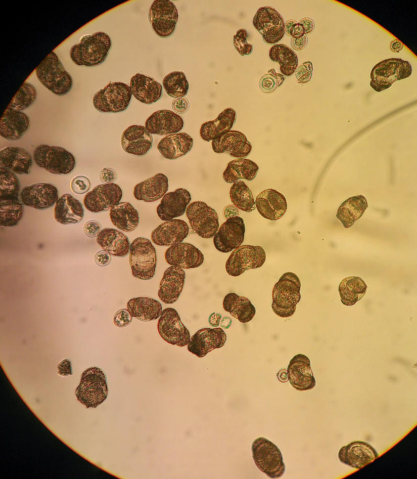 Microscopic view of several pollen grains of Pinus sylvestris