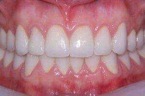 Vellykket tannbehandling hos klinikken Odontologen