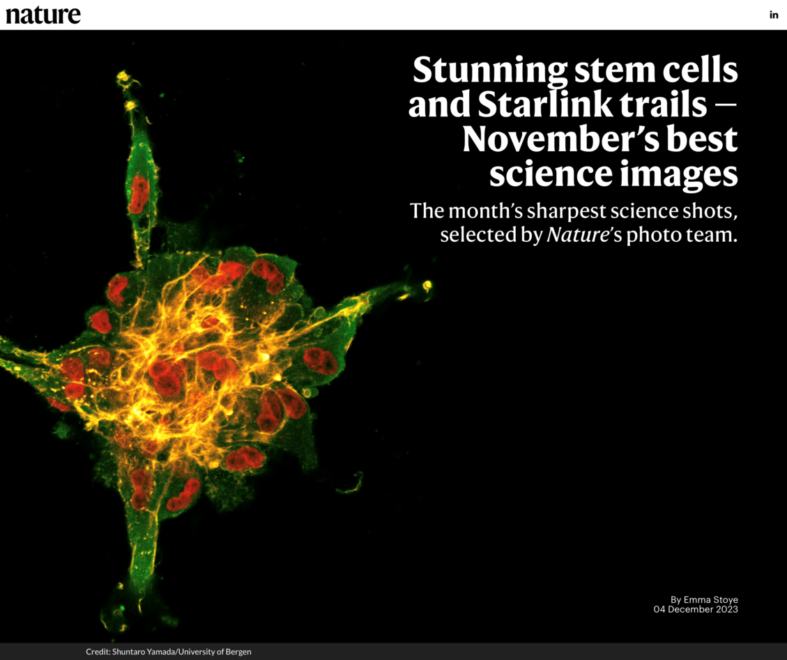 Picture of stunning stem cells and starlink trails