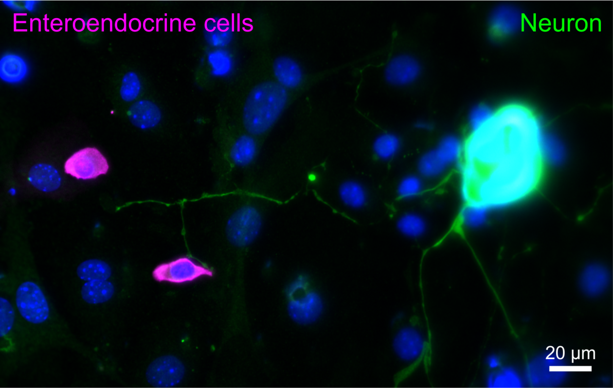 Enteroendocrine cells
