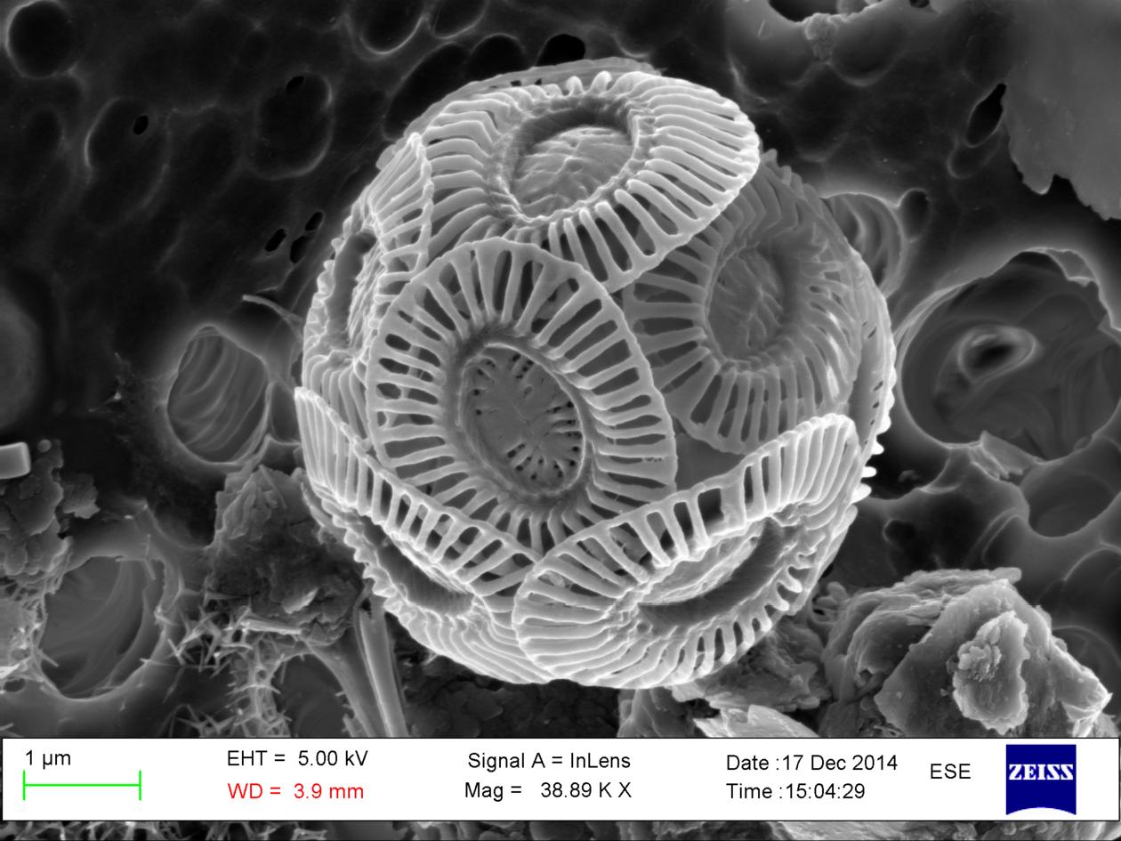 PLANTEPLANKTON: Ørsmå organismer, men uendelig viktige. Planteplankton utgjør selve fundamentet i den arktiske næringspyramiden. Dette bildet av Coccolithus pelagicus er tatt ved hjelp av elektronmikroskop. (Foto: Sesilie F. Tverberg)