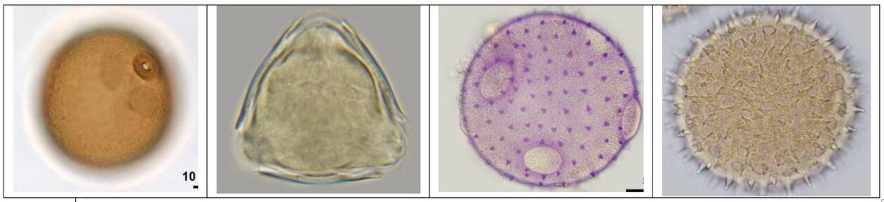 Pollen through a microscope