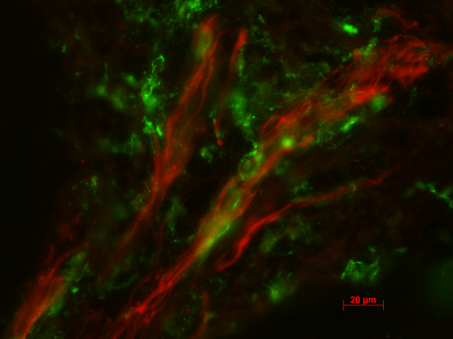 Immunofluorescense image of lymphatic vessels (red) and macrophages (green)...