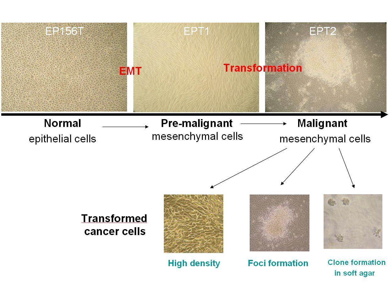 The figure shows the new cell culture model of stepwise prostate carcinogenesis.