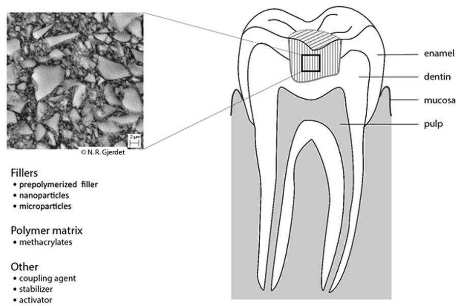 Composite dental filling exposure routes (from V. Ansteinsson's PhD thesis)