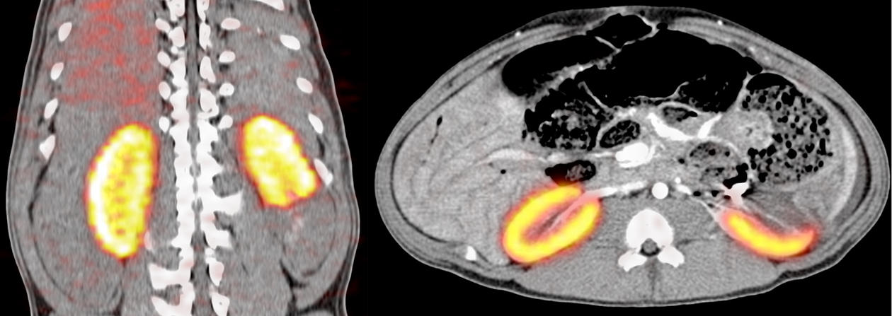 PET-CT som viser glomerulusfiltrasjon i en anestesert gris etter avstengning...