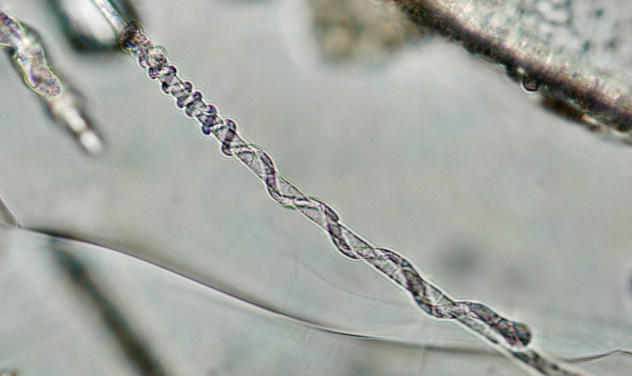 I mikroskop er det mulig å se hvordan mikrober spiser seg innover stein, og...