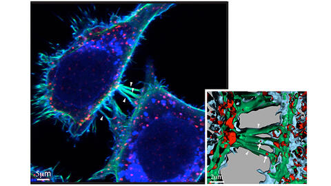 Kreftceller utveksler protein via nanorør mellom to naboceller