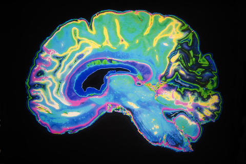 Scan of a human brain, to accompany an article about a new theory of cognitive functions.