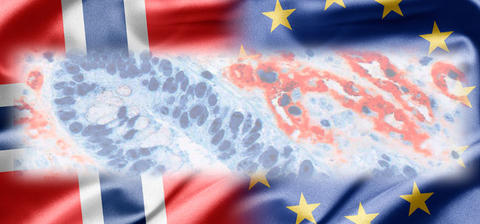 EU flag and Norwegian flag together with cancer research microscope photo