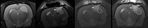 The image shows the MRI scans