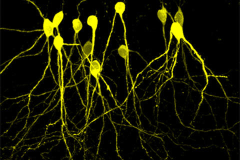 Hipppocampal neurons