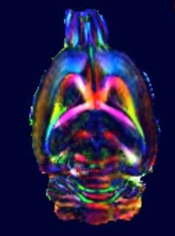 Diffusion tensor imaging (DTI) som syner den kvite substanstrakta i rottehjernen