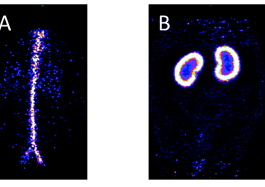 Abodominal aorta acts as a reference for the input function.Tracer distribution mostly in the kidney cortex.