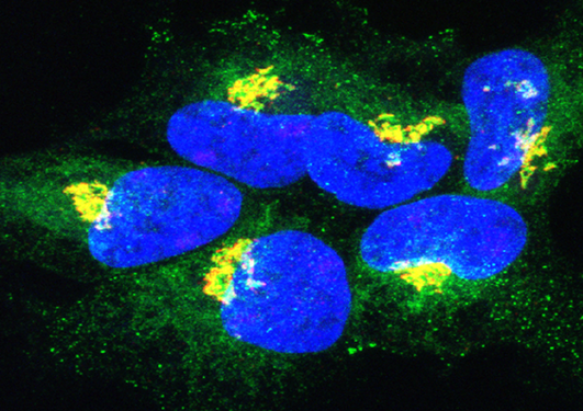 Altered CEL protein accumulates inside the cells (yellow-green color). Cell nuclei are stained blue.