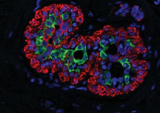 Light microscopic image of breast tissue labelles with fluorescent dyes